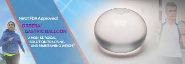 the gastric balloon