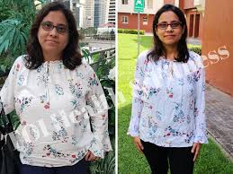 If the bones are significantly displaced (the bone alignment has been lost or there is an associated. Weight Loss Story I Lost 15 Kilos By Changing My Diet And Walking For 30 Minutes Every Day Times Of India