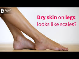 get rid of very dry flaky skin on legs