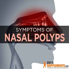 nasal polyps our supplements help you