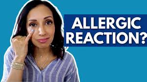 allergic reaction to eye makeup eye