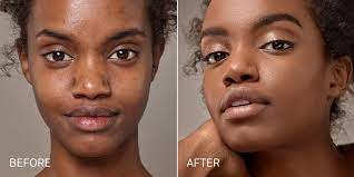 how to cover hyperpigmentation cover