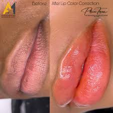 best permanent lip contour treatment