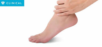 Learn more about your condition and possible remedies for relief. What Is Foot Drop Orthotix