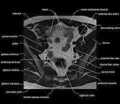 mri pelvis anatomy free male pelvis