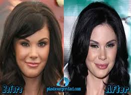 jayde nicole plastic surgery before and