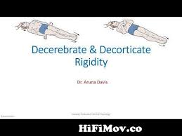 decerebrate vs decorticate posturing