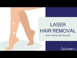 toronto laser hair removal