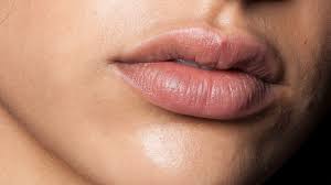 how chapped lips could be caused by dry