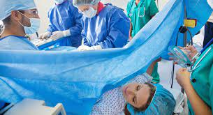 c section giving birth by caesarean
