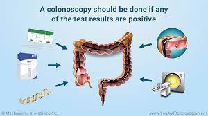 You and Colonoscopy gambar png