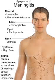 Moisturisers can help, gentle exfoliation too. Meningococcal Meningitis Symptoms