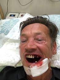 Owen williams 5 episodes, 2020 keara graves. Ex Eastenders Star Sid Owen Has Jaw Shattered And Six Teeth Smashed Out By A Golf Ball On Thai Getaway