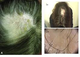 8 common scalp problems photos causes