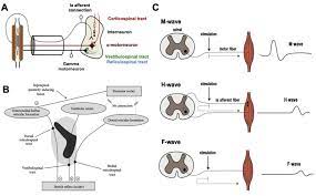 spasticity and mouse models