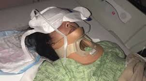 Image result for Teen critically injured after trying viral â€˜KiKi Challengeâ€™