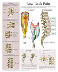 Low Back Pain E Chart Quick Reference Guide