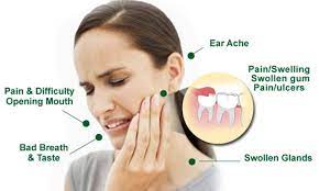 wisdom teeth pain relief 8 remes