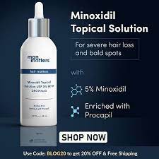 minoxidil shedding increased hair fall