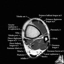 Click on the links to show each structure. Mri Msk Anatomy Anatomy Drawing Diagram
