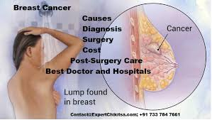 Avoiding financial disaster can add stress to patient's battle against the disease. Breast Cancer Treatment In India Find Best Breast Cancer Specialists Cost Estimate Success Rate Contact Us Now