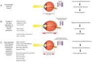 JCM | Free Full-Text | Myopia Is an Ischemic Eye Condition: A ...