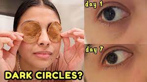 i tried to remove dark circles in 7