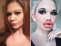 woman biggest lips this woman might