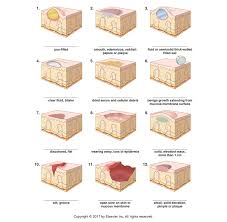 Skin Lesions Labeling Diagram Quizlet