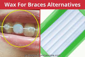 Using a metal tablespoon over a lit candle, melt the dental wax. What To Use Instead Of Wax For Braces 5 Alternatives Orthodontic Braces Care
