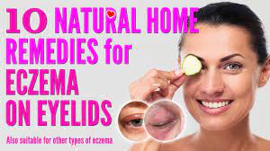 treat eczema eyelids