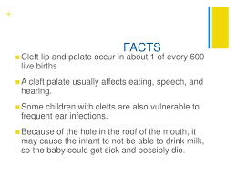 ppt cleft lip cleft palate powerpoint