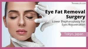 eye fat removal surgery lower
