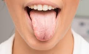 what causes dry mouth how to relieve