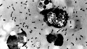 Resultado de imagen de la peste negra