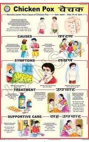 Chicken Pox For Prevent Diseases Chart