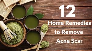 home remes for acne tibot