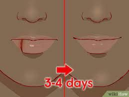 how to treat a cut lip with pictures