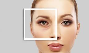 which type of eyelid surgery is right