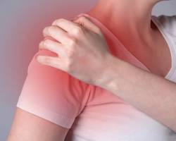 Hình ảnh về Cơ xương khớp đau nhức