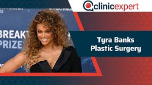 tyra banks plastic surgery clinicexpert