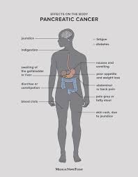Pancreatic cancer that grows into or presses on the first part of the small intestine (duodenum) can. Pancreatic Cancer Symptoms Causes And Treatment