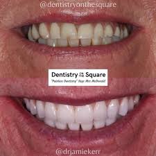 Maybe you would like to learn more about one of these? Dental Implants Glasgow