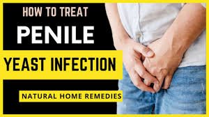 penile yeast infection how to treat
