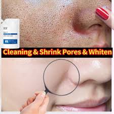 anti acne mask to remove melanin