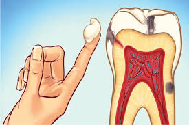 toothache symptoms causes and