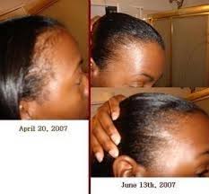 Be sure to coat the entire scalp by parting the hair in sections and applying the oil. Fast Growth Hair Oil Grow Hair Edges Back Hair Growth Oil Hair Growth Faster Jamaican Black Castor Oil Hair Growth