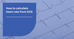 how to calculate heart rate from ecg