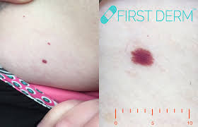red spots on skin pictures causes