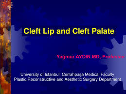 ppt cleft lip and cleft palate